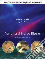Peripheral Nerve Blocks