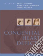 Congenital Heart Defects
