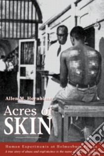 Acres of Skin libro in lingua di Hornblum Allen M.