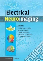 Electrical Neuroimaging