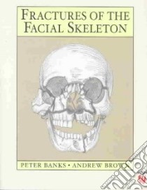 Fractures of the Facial Skeleton libro in lingua di Banks Peter, Brown Andrew