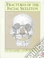 Fractures of the Facial Skeleton