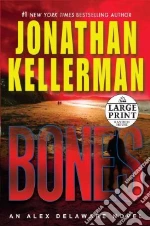 Bones