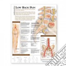 Understanding Low Back Pain Anatomical Chart libro in lingua di Lippincott Williams & Wilkins (COR)