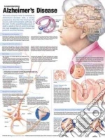 Understanding Alzheimer's Disease
