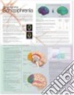 Understanding Schizophrenia Anatomical Chart