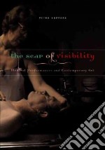 The Scar of Visibility