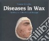 Diseases in Wax libro str