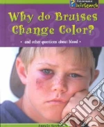 Why Do Bruises Change Color?