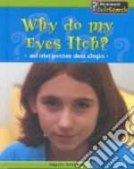 Why Do My Eyes Itch?