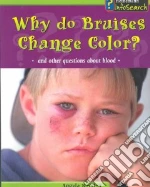 Why Do Bruises Change Color?