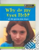 Why Do My Eyes Itch