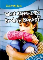 What Happens to Broken Bones?