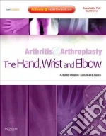 Arthritis and Arthroplasty