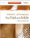 Arthritis and Arthroplasty libro str