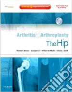Arthritis & Arthroplasty