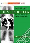 Chest Radiology libro str