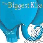 The Biggest Kiss