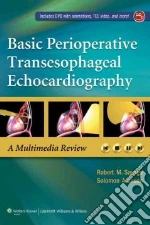 Basic Perioperative Transesophageal Echocardiography