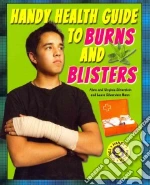 Handy Health Guide to Burns and Blisters