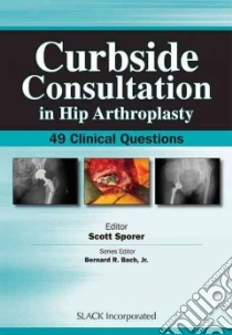 Curbside Consultation in Hip Arthroplasty libro in lingua di Sporer Scott M. M.d.