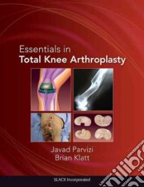 Essentials in Total Knee Arthroplasty libro in lingua di Parvizi Javad (EDT), Klatt Brian A. M.D. (EDT)