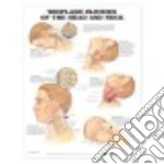 Whiplash Injuries Of Head & Neck Chart