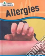 Allergies