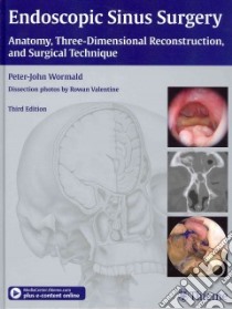 Endoscopic Sinus Surgery libro in lingua di Wormald Peter-John M.D.