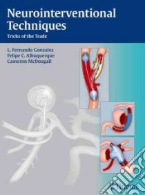 Neurointerventional Techniques libro in lingua di Gonzalez L. Fernando M.D. (EDT), Albuquerque Felipe C. M.D. (EDT), McDougall Cameron G. M.D. (EDT)