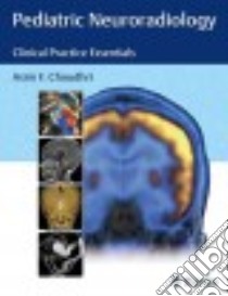 Pediatric Neuroradiology libro in lingua di Choudhri Asim F. M.D.