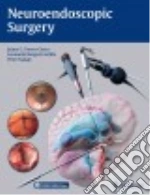Neuroendoscopic Surgery