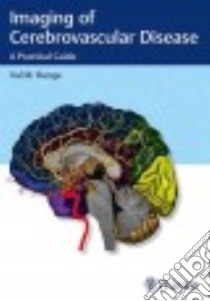 Imaging of Cerebrovascular Disease libro in lingua di Runge Val M. M.D.