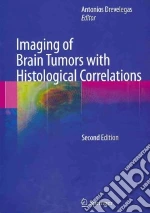 Imaging of Brain Tumors With Histological Correlations