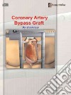 Coronary Artery Bypass Graft libro str