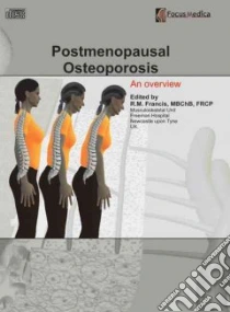 Postmenopausal Osteoporosis libro in lingua di Francis R. M. (EDT)