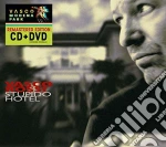 Vasco Rossi - Stupido Hotel (Cd+Dvd) cd