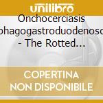 Onchocerciasis Esophagogastroduodenoscopy - The Rotted Plinth Of Sachiel cd