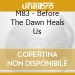 M83 - Before The Dawn Heals Us cd