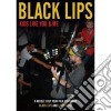 (Music Dvd) Black Lips (The) - Kids Like You & Me cd