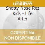 Snotty Nose Rez Kids - Life After cd
