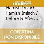 Hamish Imlach - Hamish Imlach / Before & After / Live / 2 Sides Of (2 Cd) cd