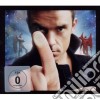 Robbie Williams - Intensive Care (Special Edition) (Cd+Dvd) cd