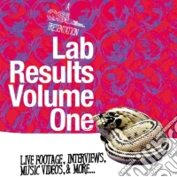 Lab Results [Edizione: Regno Unito] dvd