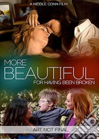 More Beautiful For Having Been Broken [Edizione: Stati Uniti] dvd