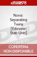 Nova: Separating Twins [Edizione: Stati Uniti] dvd