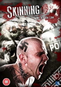 Skinning - We Are The Law dvd