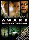 Awake - Anestesia Cosciente