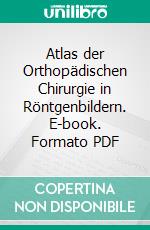 Atlas der Orthopädischen Chirurgie in Röntgenbildern. E-book. Formato PDF ebook di A. Hoffa