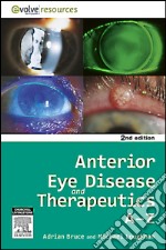 Anterior Eye Disease and Therapeutics A-Z - E-Book. E-book. Formato EPUB ebook